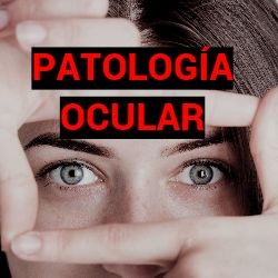 Patologia Ocular