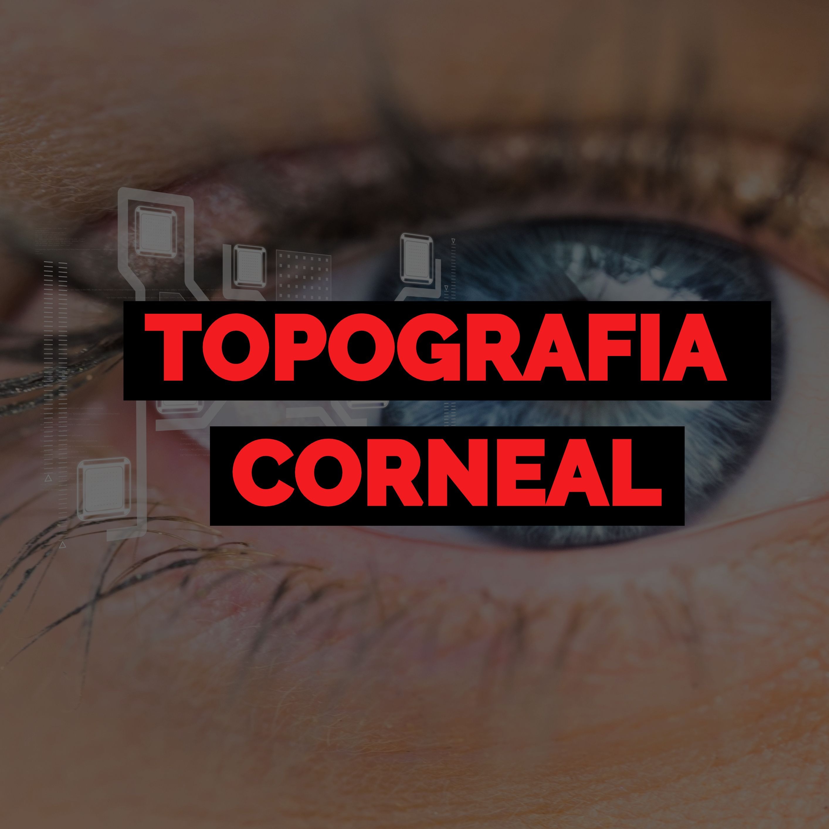 Topografia corneal